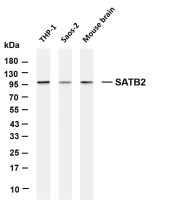 STAT5 (Phospho Tyr694) (PT0067R) PT® Rabbit mAb
