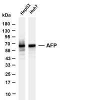 AFP (PT0713R) PT® Rabbit mAb