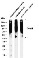 Glut1 (PT0861R) PT® Rabbit mAb
