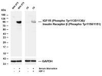 IGF1R (Phospho Tyr1135/1136)/Insulin Receptor β (Phospho Tyr1150/1151) (PT0867R) PT® Rabbit mAb