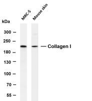 Collagen I A1(PT0817R) PT® Rabbit mAb