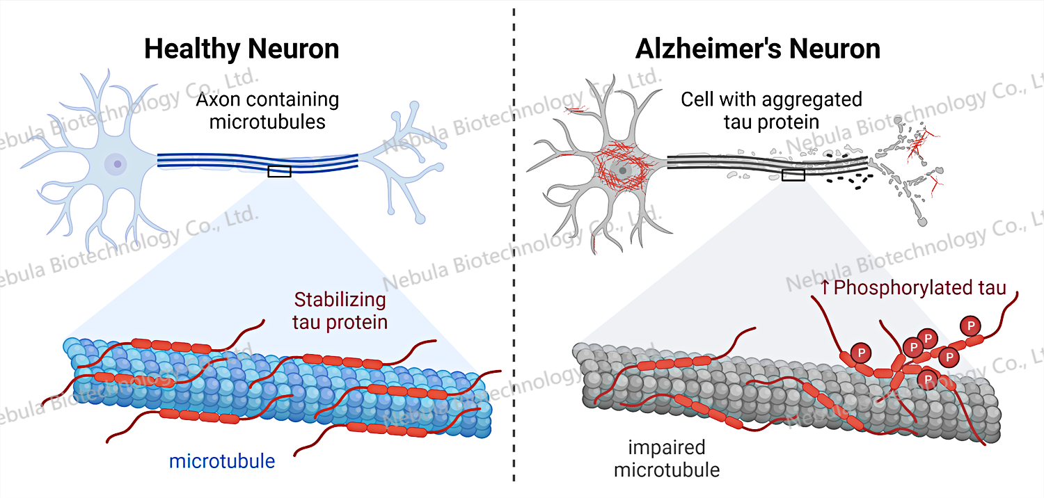 诊断原料讲堂之六：神经性退行性疾病生物标志物