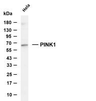PINK1 (PT0824R) PT® Rabbit mAb