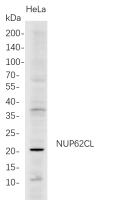 NUP62CL (PT0775R) PT® Rabbit mAb