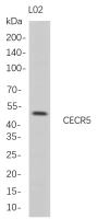 CECR5 (PT0771R) PT® Rabbit mAb