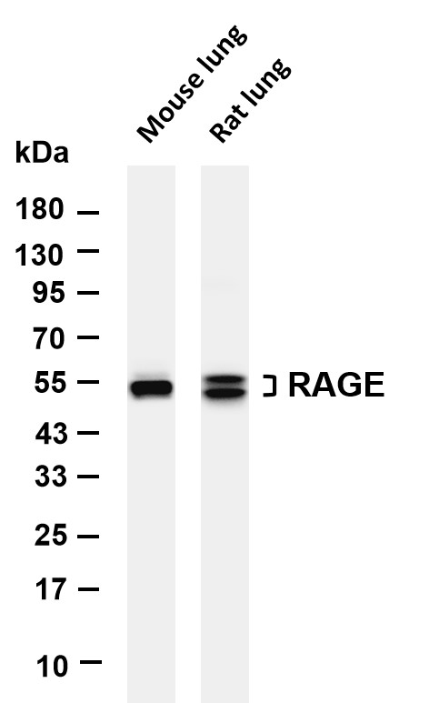 RAGE (PT0837R) PT® Rabbit mAb