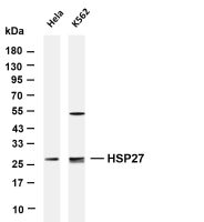 MOB1 (PT0421R) PT® Rabbit mAb