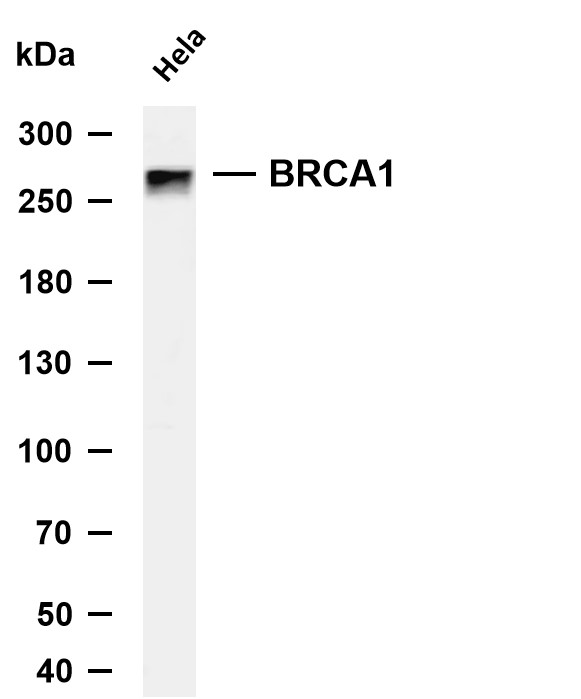 BRCA1 (PT0876R) PT® Rabbit mAb