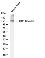 CD117/c-Kit (PT0818R) PT® Rabbit mAb