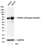 PDPK1 (Phospho Ser241) (PT0869R) PT® Rabbit mAb