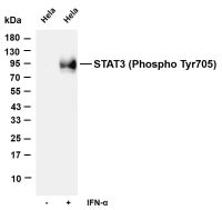 STAT3 (Phospho Tyr705) (PT0742R) PT® Rabbit mAb
