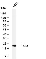 MTCO2 (PT0385R) PT® Rabbit mAb