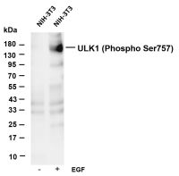 ULK1 (Phospho Ser757) (PT0739R) PT® Rabbit mAb