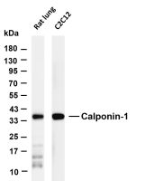 Calponin-1 (PT0714R) PT® Rabbit mAb
