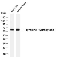 Tyrosine Hydroxylase (PT0884R) PT® Rabbit mAb