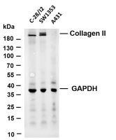 Collagen II (PT0762R) PT® Rabbit mAb