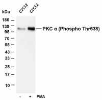 Stromal Interaction Molecule 1 (PT0730R) PT® Rabbit mAb