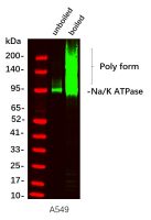 Sodium Potassium ATPase (PT0834R) PT® Rabbit mAb