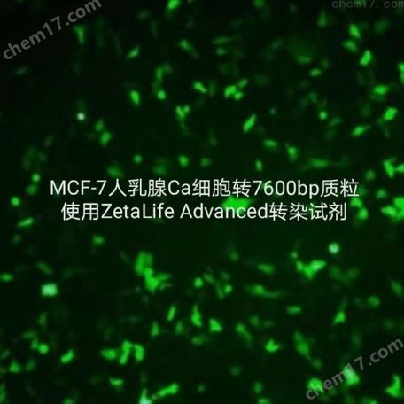 MCF-7人乳腺Ca细胞转染试剂
