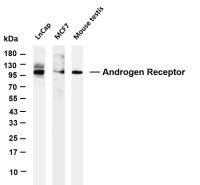 Androgen Receptor (PT0833R) PT® Rabbit mAb