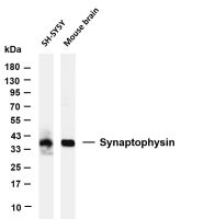 Synaptophysin (PT0840R) PT® Rabbit mAb