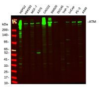 ATM (PT0836R) PT® Rabbit mAb