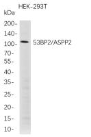 53BP2/ASPP2 (PT0791R) PT® Rabbit mAb