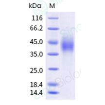 重组人 SLAMF7/CRACC/CS1 蛋白