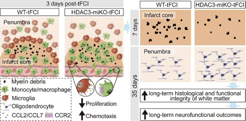 复旦大学突破性成果，揭秘小胶质细胞与巨噬细胞在缺血性中风治疗中的“命运纠缠”