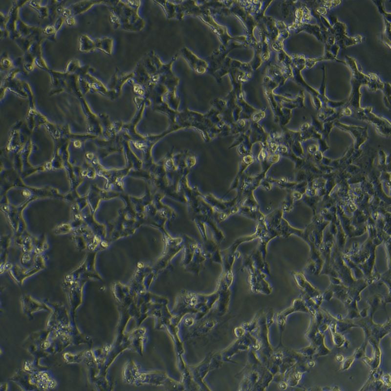 SK-N-FI(人神经母细胞瘤细胞)