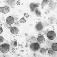 KGF/FGF-7重组蛋白|Recombinant Human FGF7 / FGF-7 / KGF Protein (His Tag)
