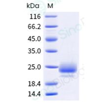 重组人 CTLA-4 蛋白 (His Tag)