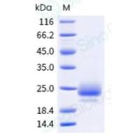 重组人 CTLA-4 蛋白 (His Tag)