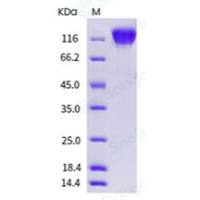 重组人 VEGFR2 蛋白