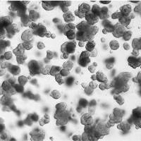 R-Spondin 1/RSPO1重组蛋白|Recombinant Human R-Spondin