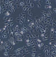 人鼻咽癌细胞；CNE2(STR hela交叉污染)