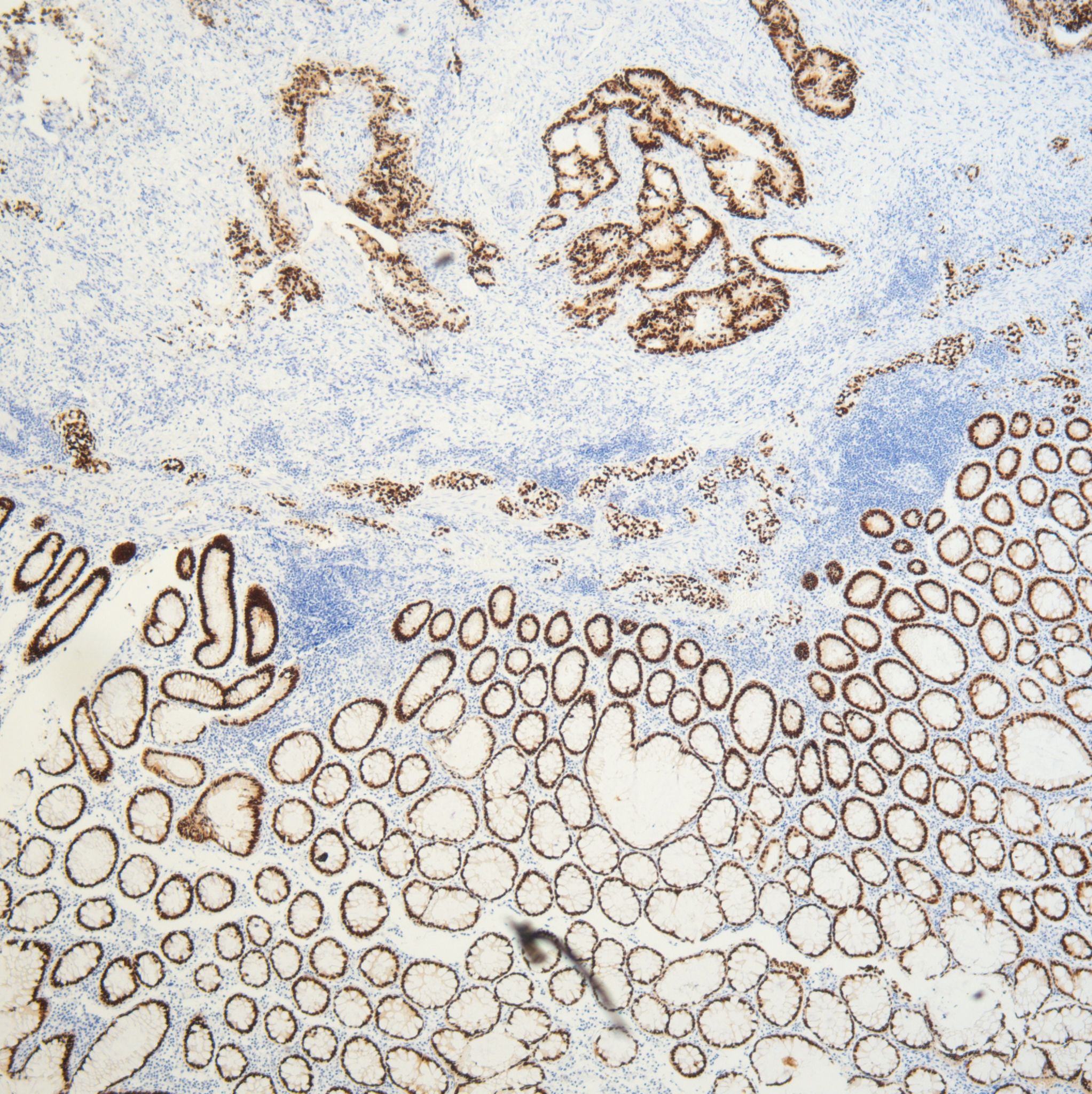 IgG 二抗（Goat Anti-Mouse）