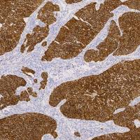 单克隆抗体 | Anti-Human CK7/Cytokeratin 7 Antibody