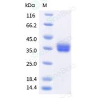 重组人 PD-L1 蛋白 (His Tag)