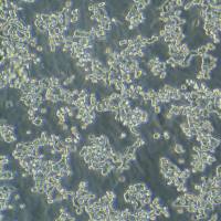 VMRC-LCD（人非小细胞肺癌细胞）