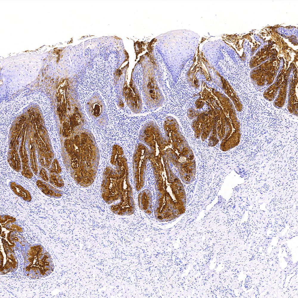 单克隆抗体 | Anti-Human CA125/MUC16 Antibody, Mouse MAb