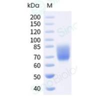 重组人 CD86 蛋白