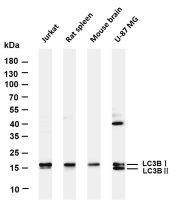 LC3B (PT0235R) PT® Rabbit mAb
