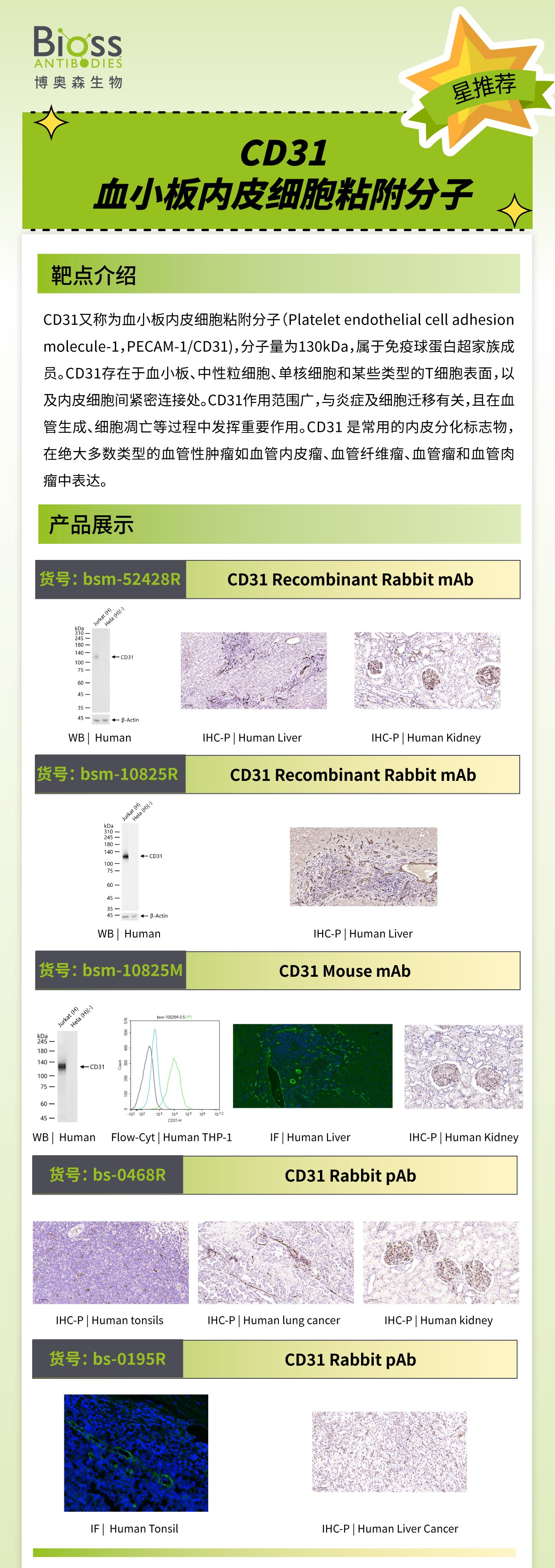 Bioss 星推荐 | CD31抗体