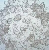 3dGRO® Duodenum Intestinal Organoids, Age 45 (Prep 83-D)