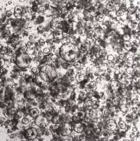 3dGRO Duodenum Intestinal Organoids, Age 33 (Prep ht-222-D)