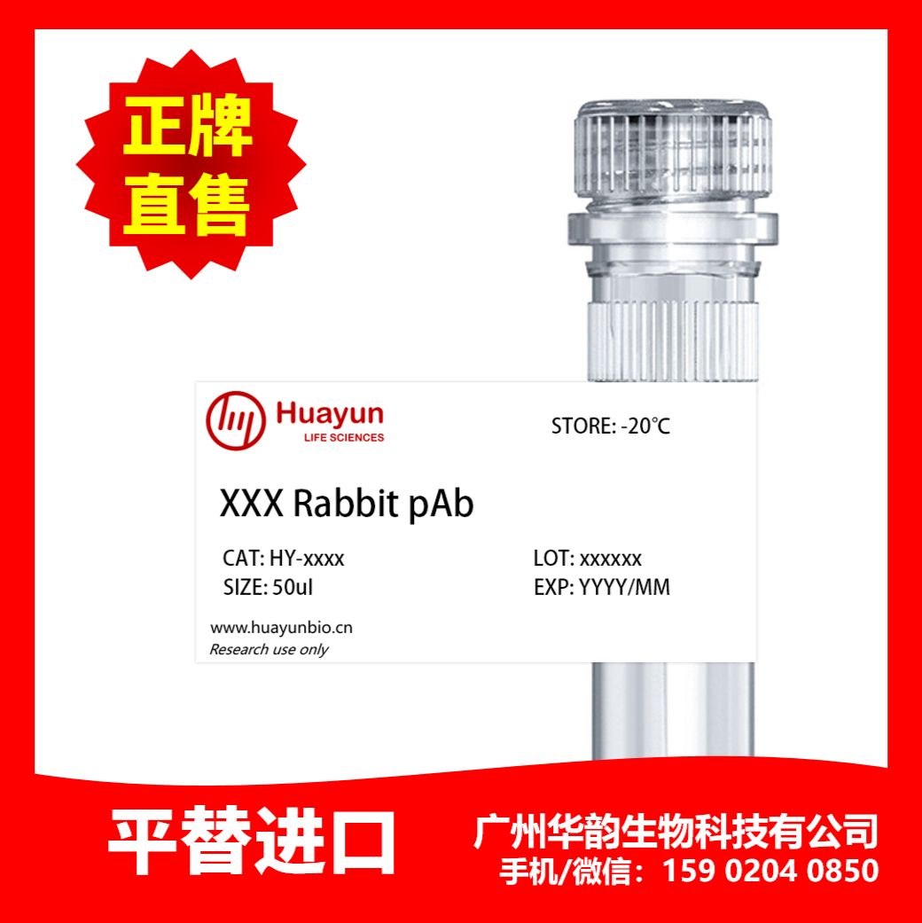 Anti-PU.1/Spi1 antibody ，应用: WB,IHC,IF/ICC，反应: H, M, R，HY- ab183327 -50ul