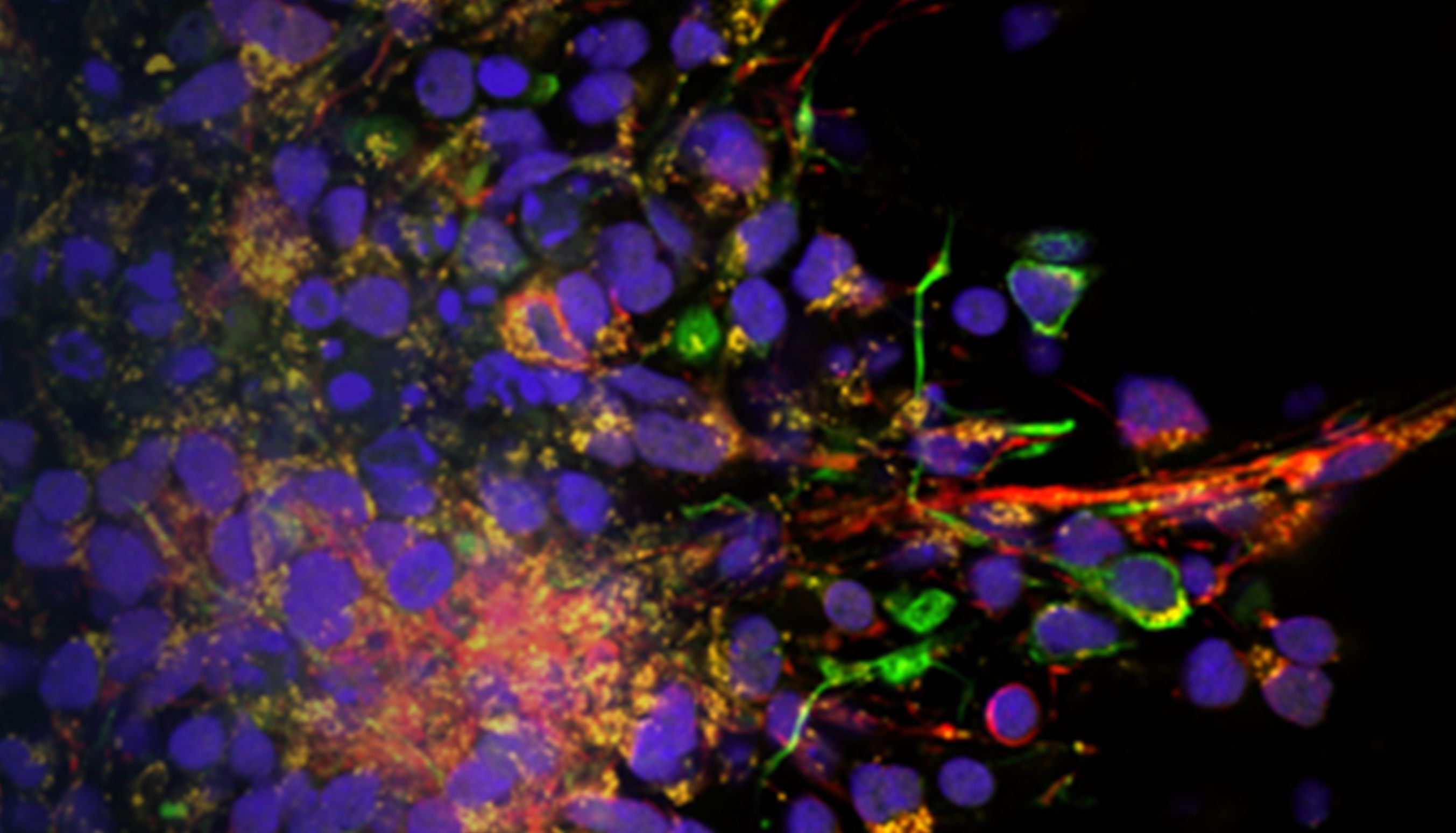 视界无界，速启新见│EVIDENT全新IXplore IX85 SpinXL和SpinSR转盘共聚焦系统发布！