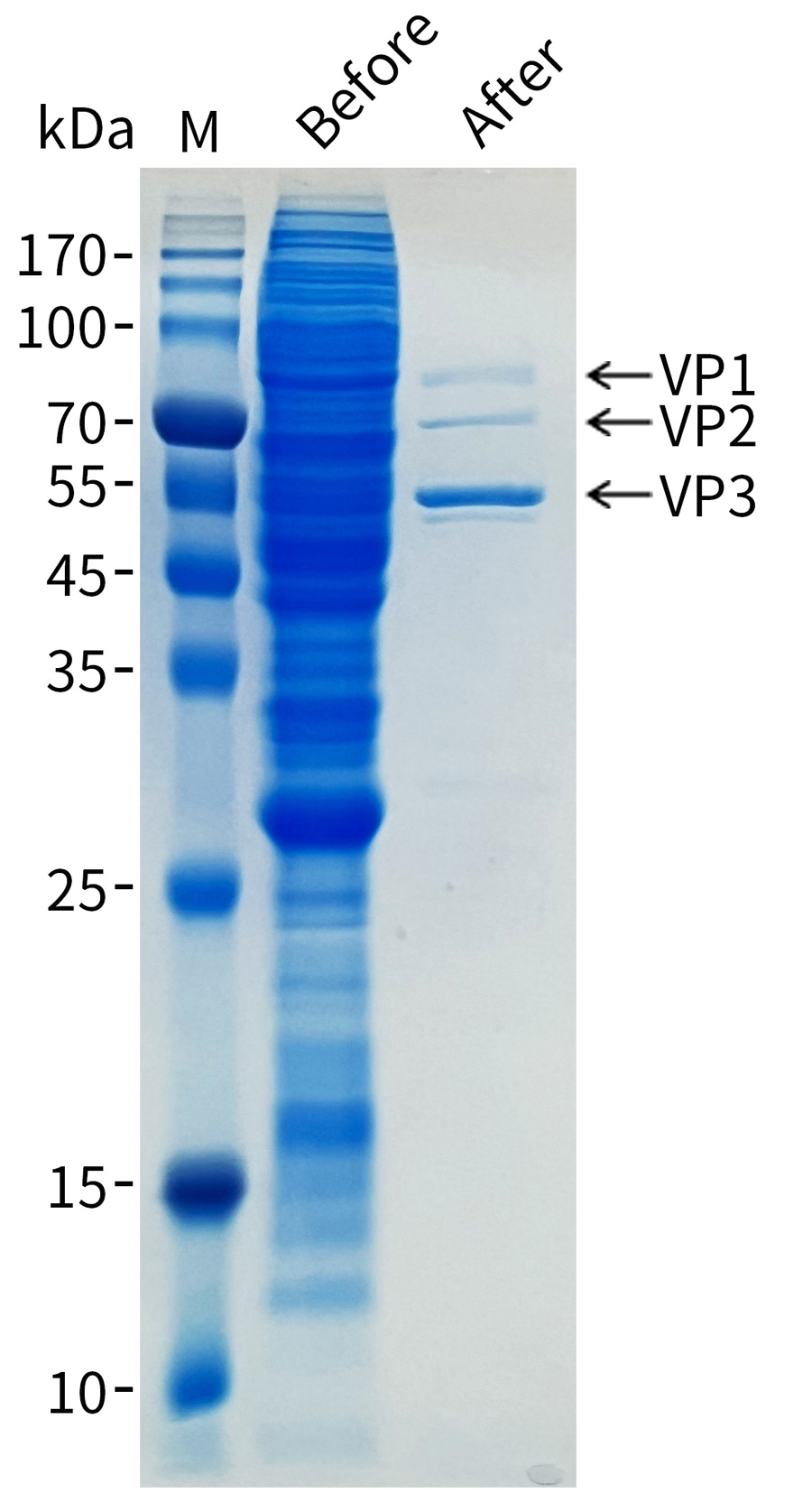 适配全血清型的AAV纯化试剂盒来啦