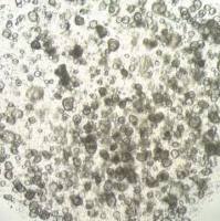 3dGRO Stomach Gastric Organoids, Age 52 (Prep ht-127-S)